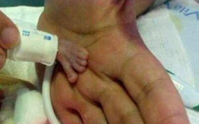 Na świat przyszło jedno z najmniejszych dzieci na świecie!
