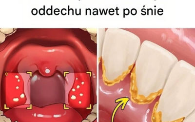 6 sprawdzonych sposobów na uniknięcie nieświeżego oddechu