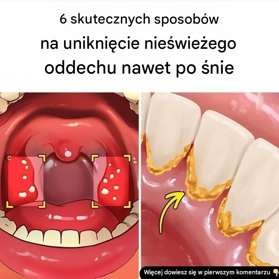 6 sprawdzonych sposobów na uniknięcie nieświeżego oddechu