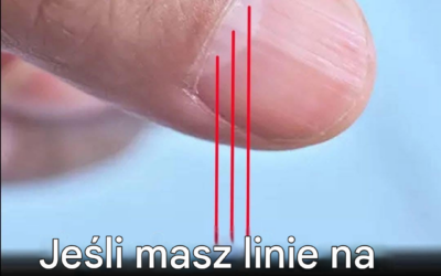 Lekarz ujawnił problemy zdrowotne ukryte w paznokciach