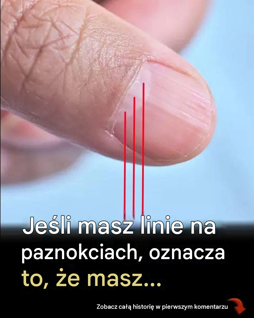 Lekarz ujawnił problemy zdrowotne ukryte w paznokciach