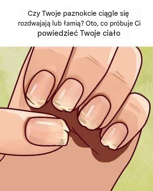 Lekarz ujawnił problemy zdrowotne ukryte w paznokciach