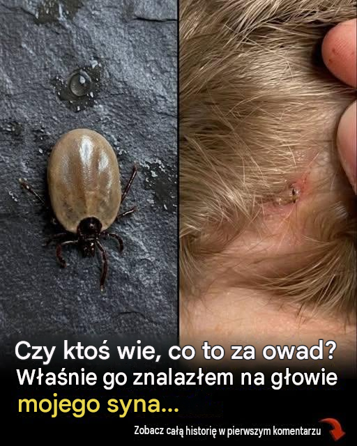 Znalazłeś coś pełzającego we włosach swojego dziecka