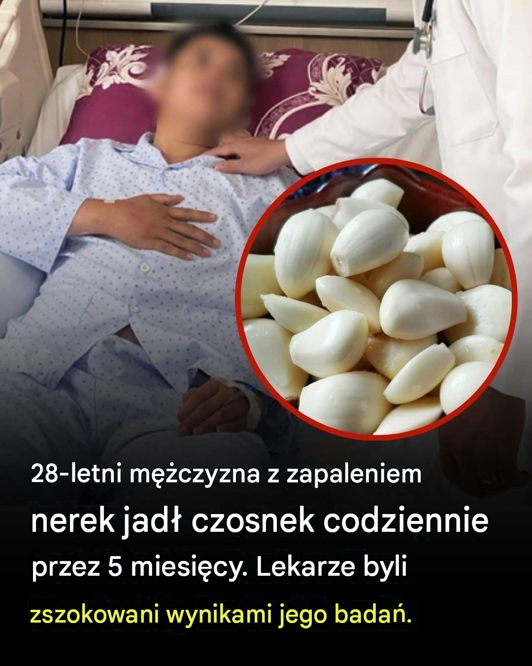 28-latek jadł czosnek codziennie przez pięć miesięcy – wyniki jego badań go zaskoczyły