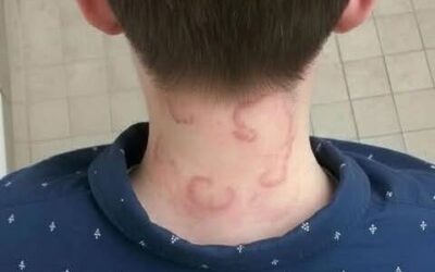 Mój 8-latek cierpi na to od 2 miesięcy i jest coraz gorzej. Co to może być?