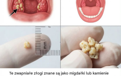 Oto, co musisz wiedzieć o kamieniach migdałkowych