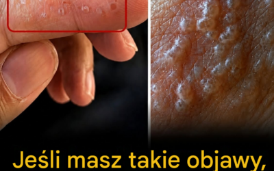 Malutkie pęcherze na palcach? Tych objawów nigdy nie należy ignorować