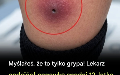 Mała plamka na skórze stała się nagłym przypadkiem wymagającym interwencji medycznej: dlaczego poważnych infekcji skóry nigdy nie należy ignorować