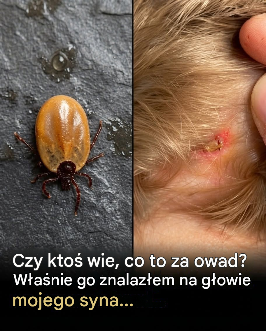 Co rodzice powinni wiedzieć o kleszczach: małe stworzenia, duże obawy
