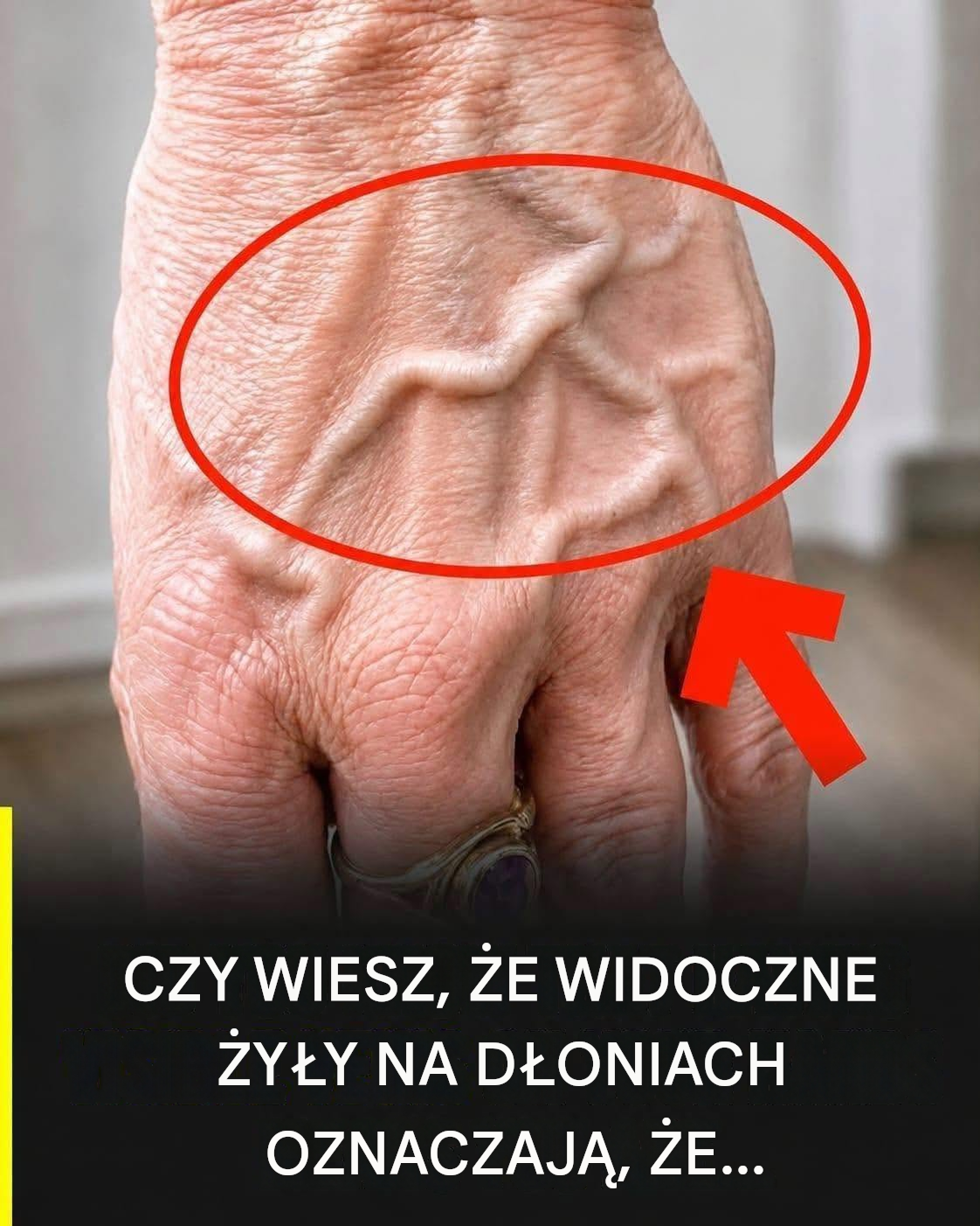 Czy wiesz, że widoczne żyły oznaczają, że… Zobacz więcej