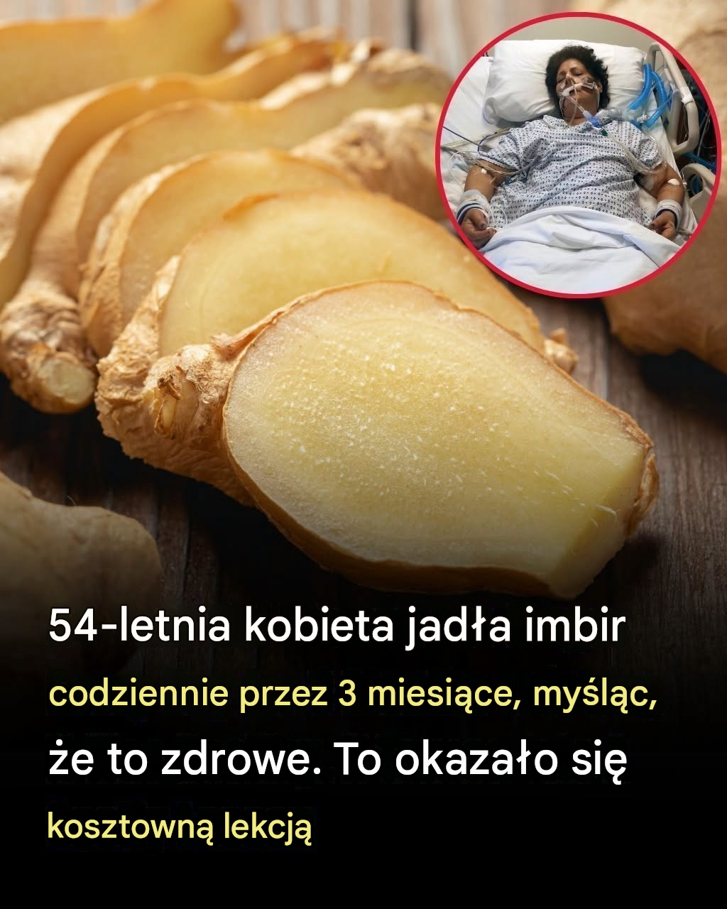 54-letnia kobieta uważała, że imbir jest zdrowy. Jadła go codziennie przez 3 miesiące i zapłaciła za to bolesną cenę.