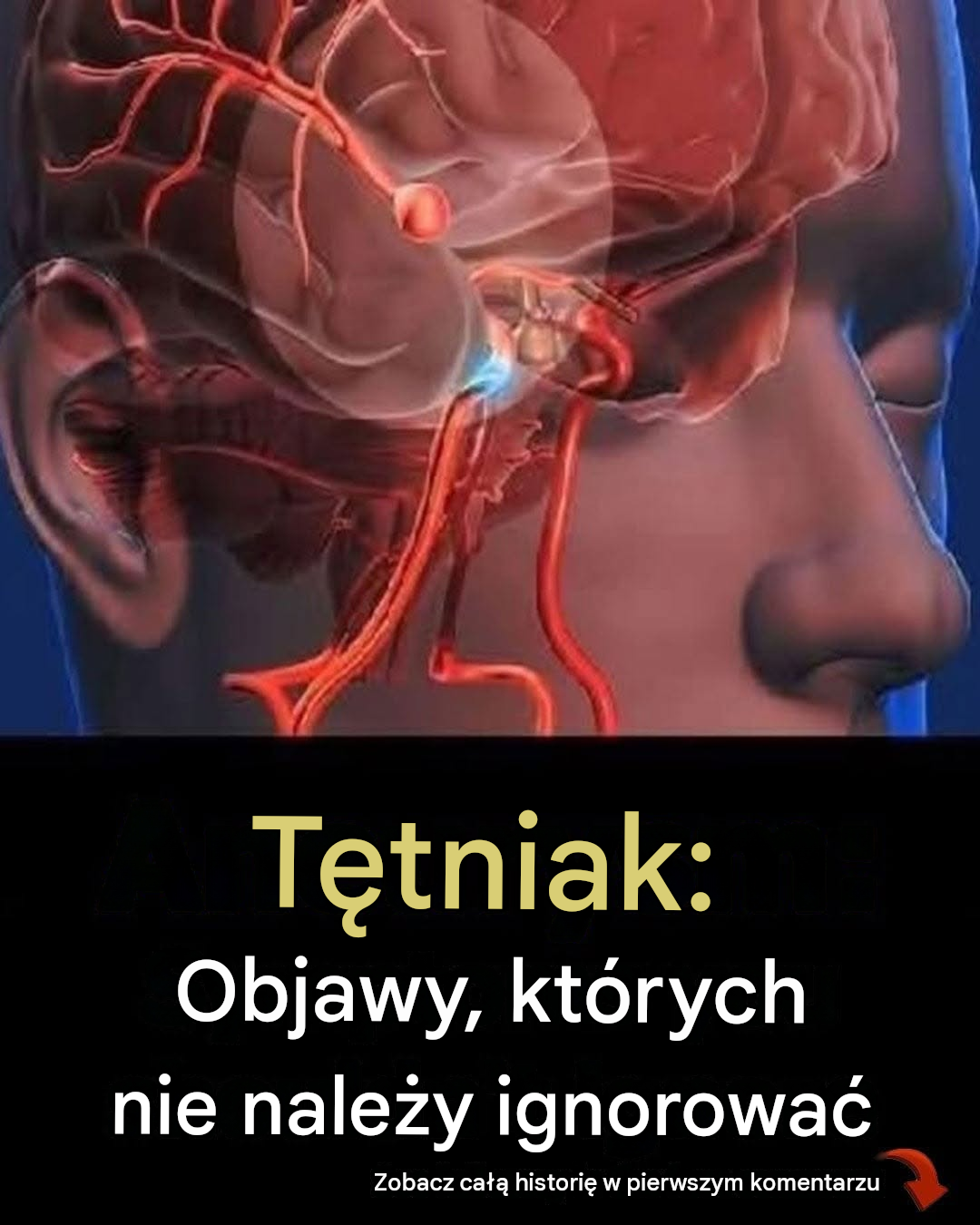 12 wczesnych objawów tętniaka, których nie należy ignorować