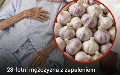 28-letni mężczyzna jadł czosnek codziennie przez pięć miesięcy. Co mogą wykazać jego badania lekarskie?