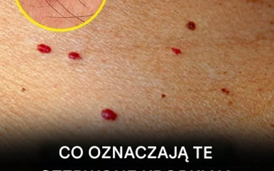 11 powodów, dla których na skórze pojawiają się czerwone plamy