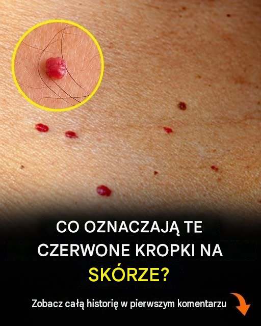 11 powodów, dla których na skórze pojawiają się czerwone plamy