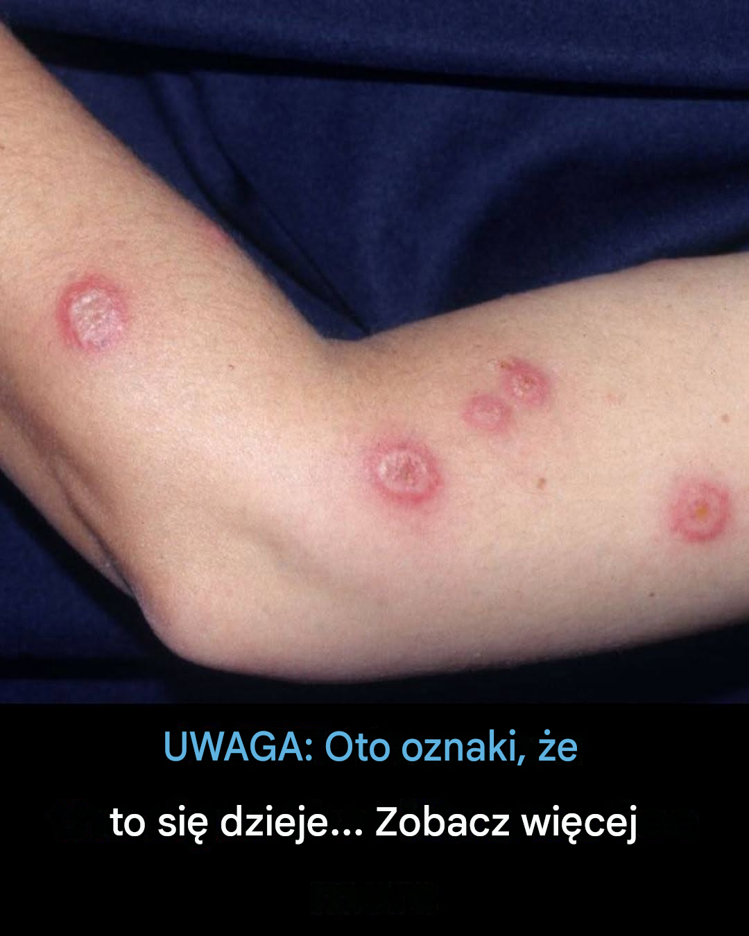 Twoja skóra może Ci coś mówić: co mogą oznaczać małe czerwone kropki