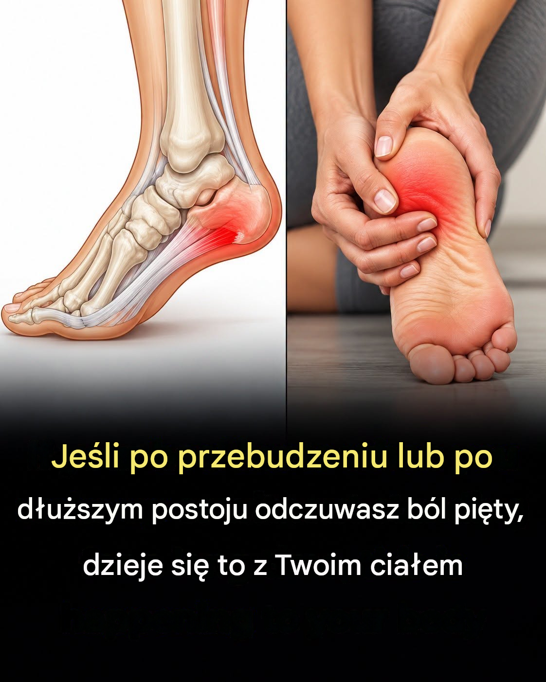 7 skutecznych ćwiczeń, które pomogą złagodzić ból pięty i naturalnie leczyć zapalenie rozcięgna podeszwowego