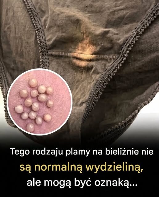 Tego rodzaju plamy na bieliźnie nie są normalną wydzieliną, ale mogą być oznaką...