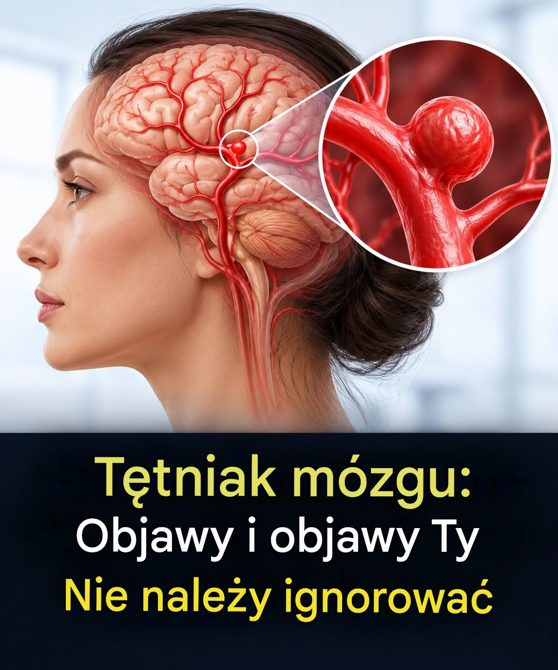 12 oznak, które mogą wskazywać na tętniaka mózgu — nie ignoruj ​​ich