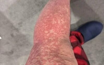Oto konsekwencje spania z… Zobacz więcej