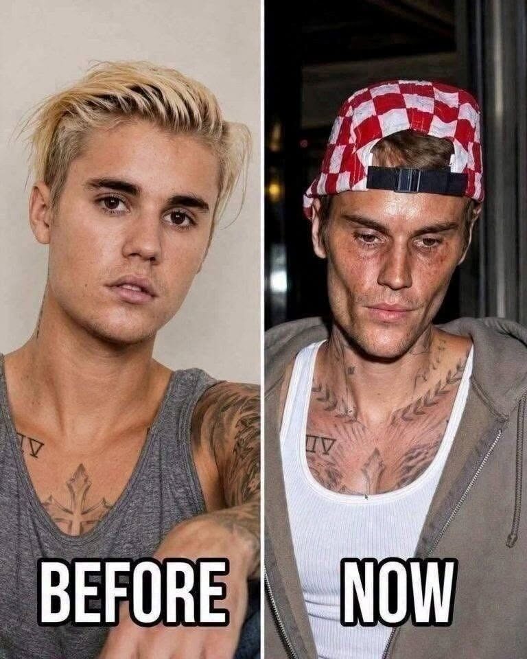 Justin Bieber przyznaje, że uzyskał pozytywny wynik testu na…Zobacz więcej