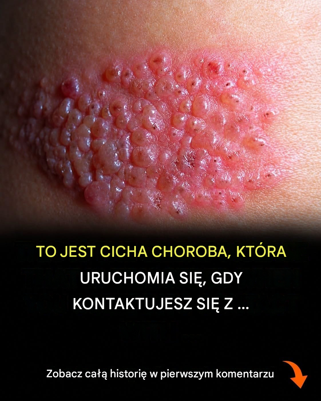 Wirus, który ukrywa się przez lata, aż organizm nie będzie w stanie go dłużej kontrolować