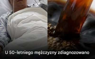 U 50-letniego mężczyzny zdiagnozowano zaawansowaną niewydolność nerek – lekarze twierdzą, że jego codzienne picie kawy to nie wszystko