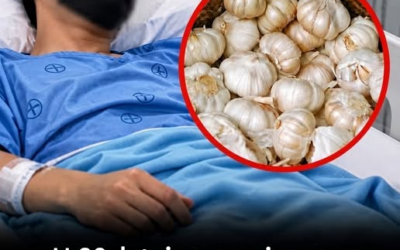 U 28-latka wystąpiło zapalenie nerek po codziennym jedzeniu czosnku: czego możemy się z tego nauczyć?