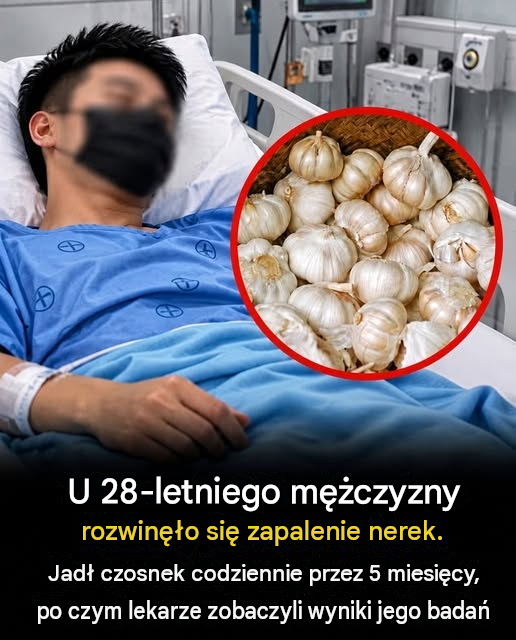 U 28-latka wystąpiło zapalenie nerek po codziennym jedzeniu czosnku: czego możemy się z tego nauczyć?