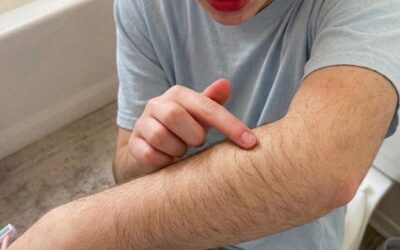 Pierwszy chłopak nastolatki doprowadził ją do płaczu z powodu włosów na rękach – zamiast się wściekać, ojciec zaprosił go na kolację