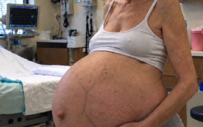 Zaszłam w ciążę w wieku 61 lat i wszyscy mówili, że to cud — ale podczas rutynowego badania mój lekarz nagle zamilkł i poprosił mojego męża, żeby opuścił pokój