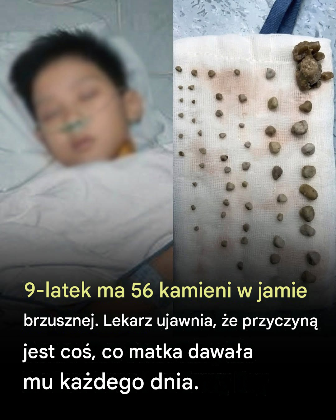 Tajemnicze kamienie 9-letniego chłopca: dlaczego codzienne nawyki dzieci mają znaczenie dla zdrowia nerek i układu moczowego
